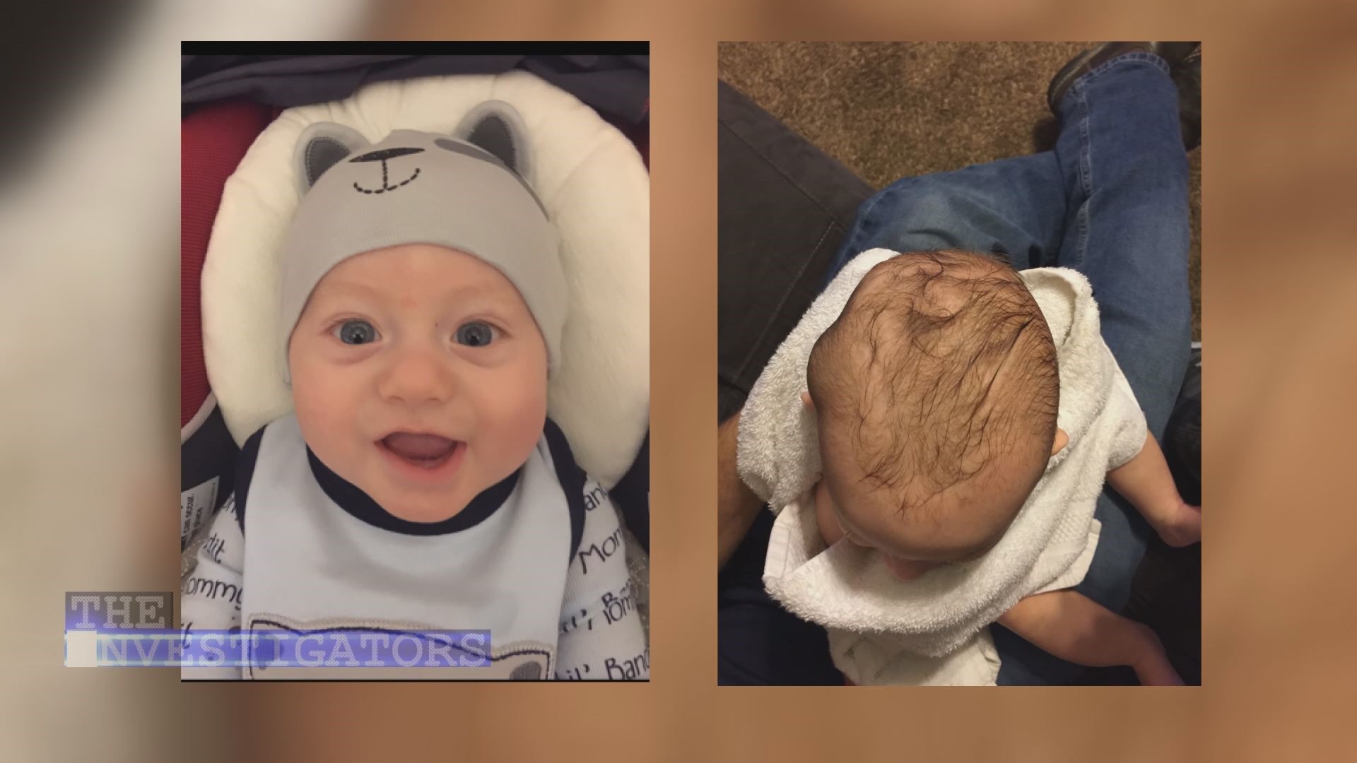 Baby S Skull Is Fractured At Daycare And No One Knows What Happened