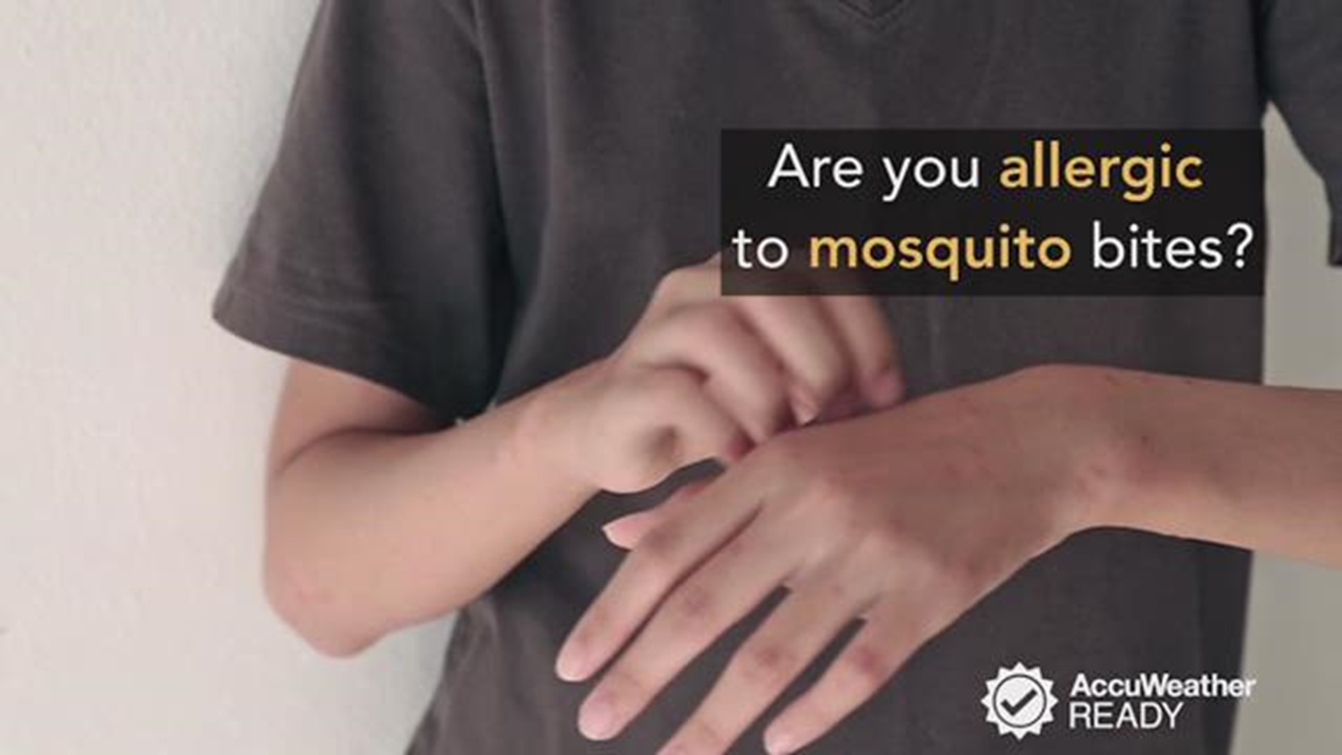 Itchy mosquito bites are a pesky annoyance for most people, but others can experience severe symptoms of an allergic reaction. 