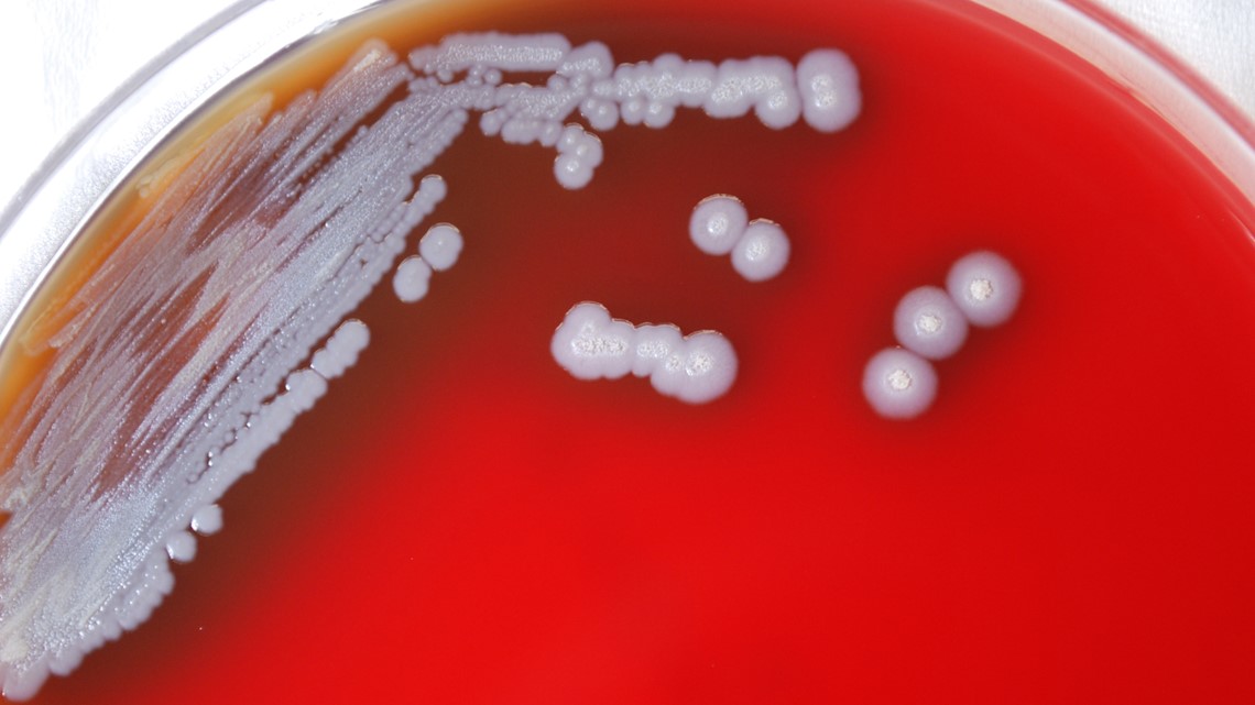 What Is Melioidosis? CDC Issues Alert After Bacteria Found In MS ...