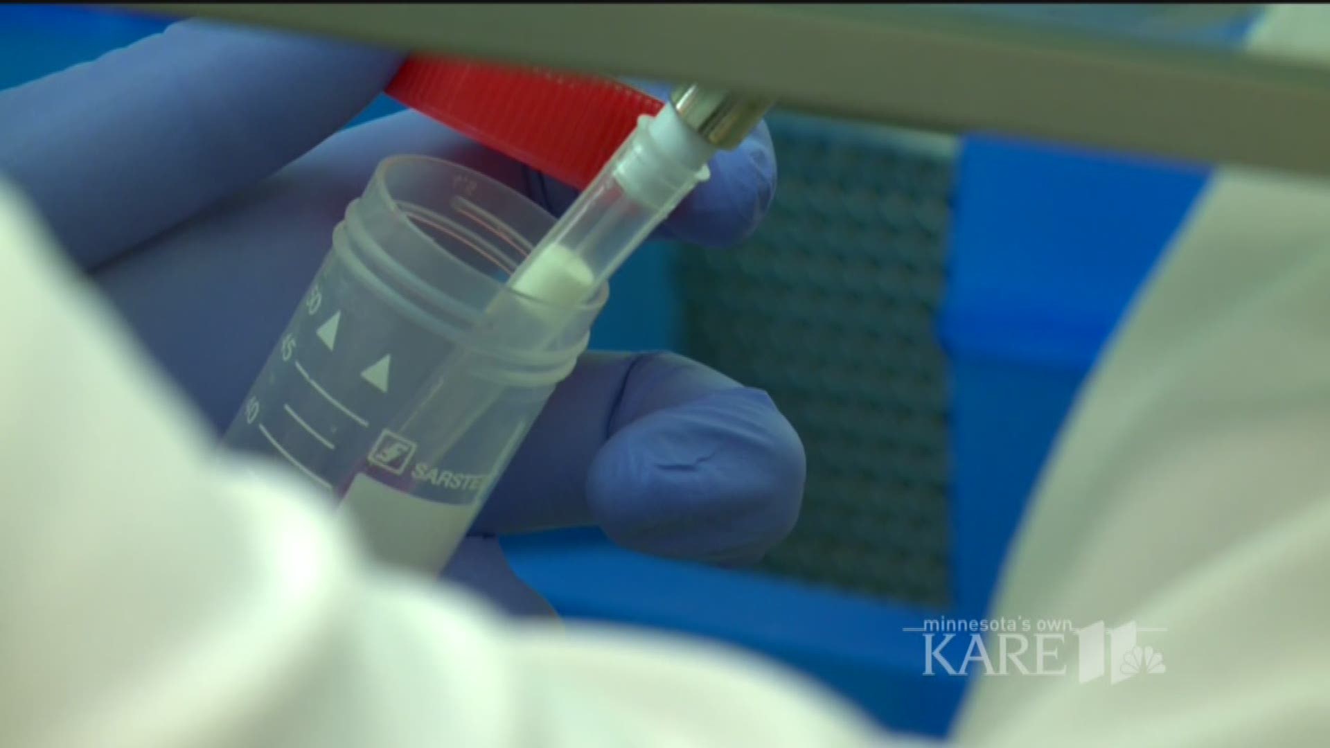 U of M researchers developing vaccine to prevent mono, MS