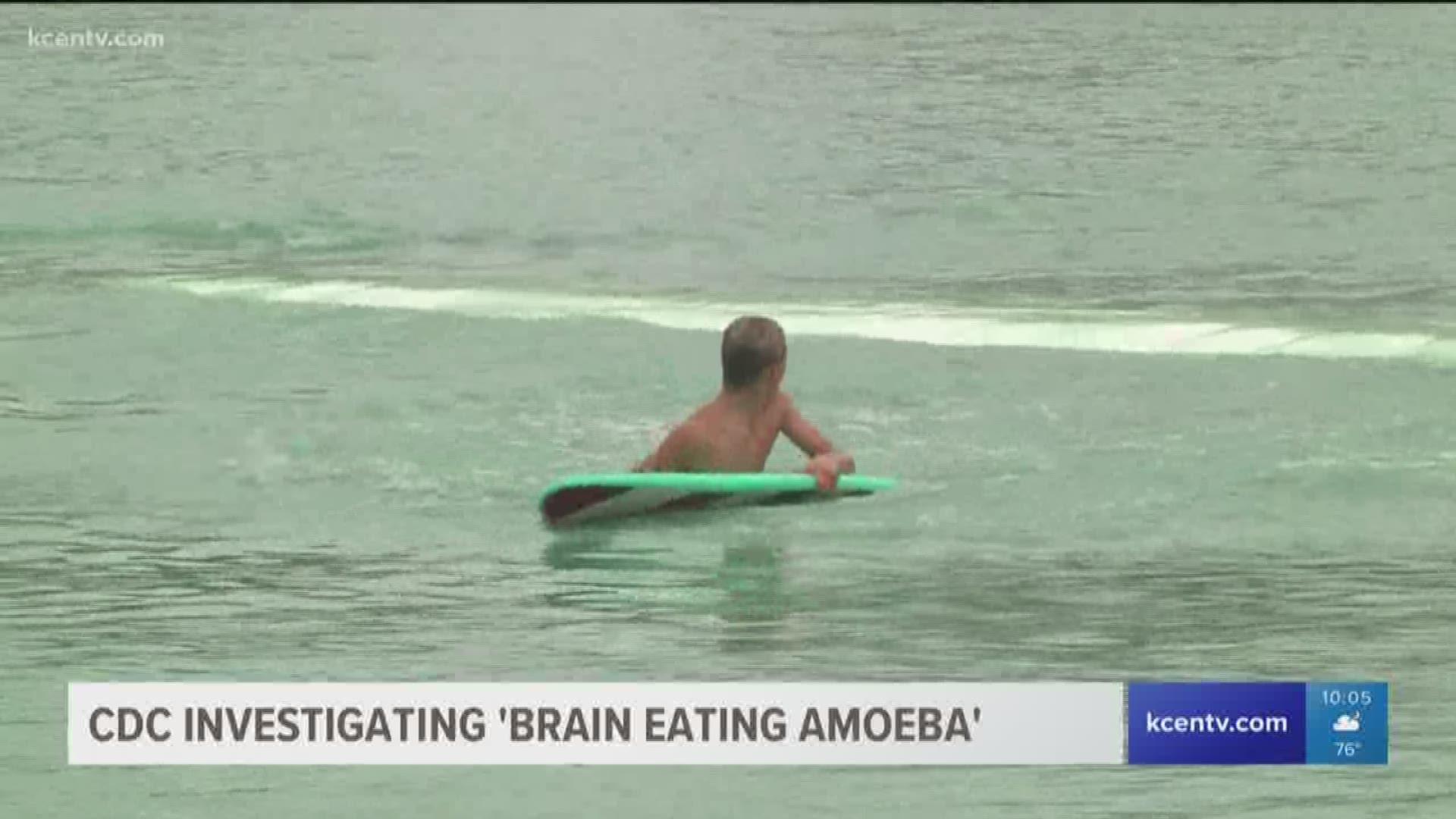 Surfer dies from 'brain-eating amoeba' after visiting wave