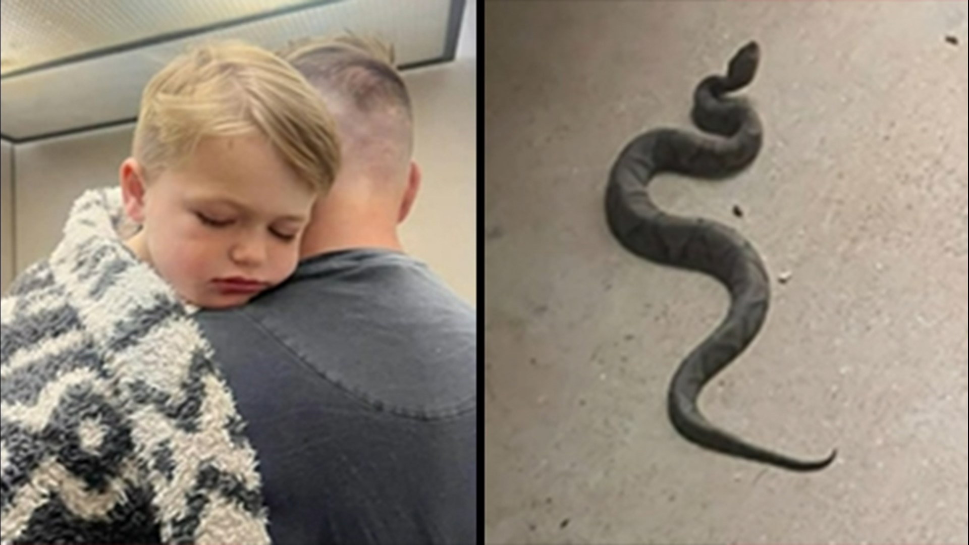 Jad Pollom was bitten by a venomous copperhead while camping with his family in North Carolina. Experts say his parents did the right thing after the bite.