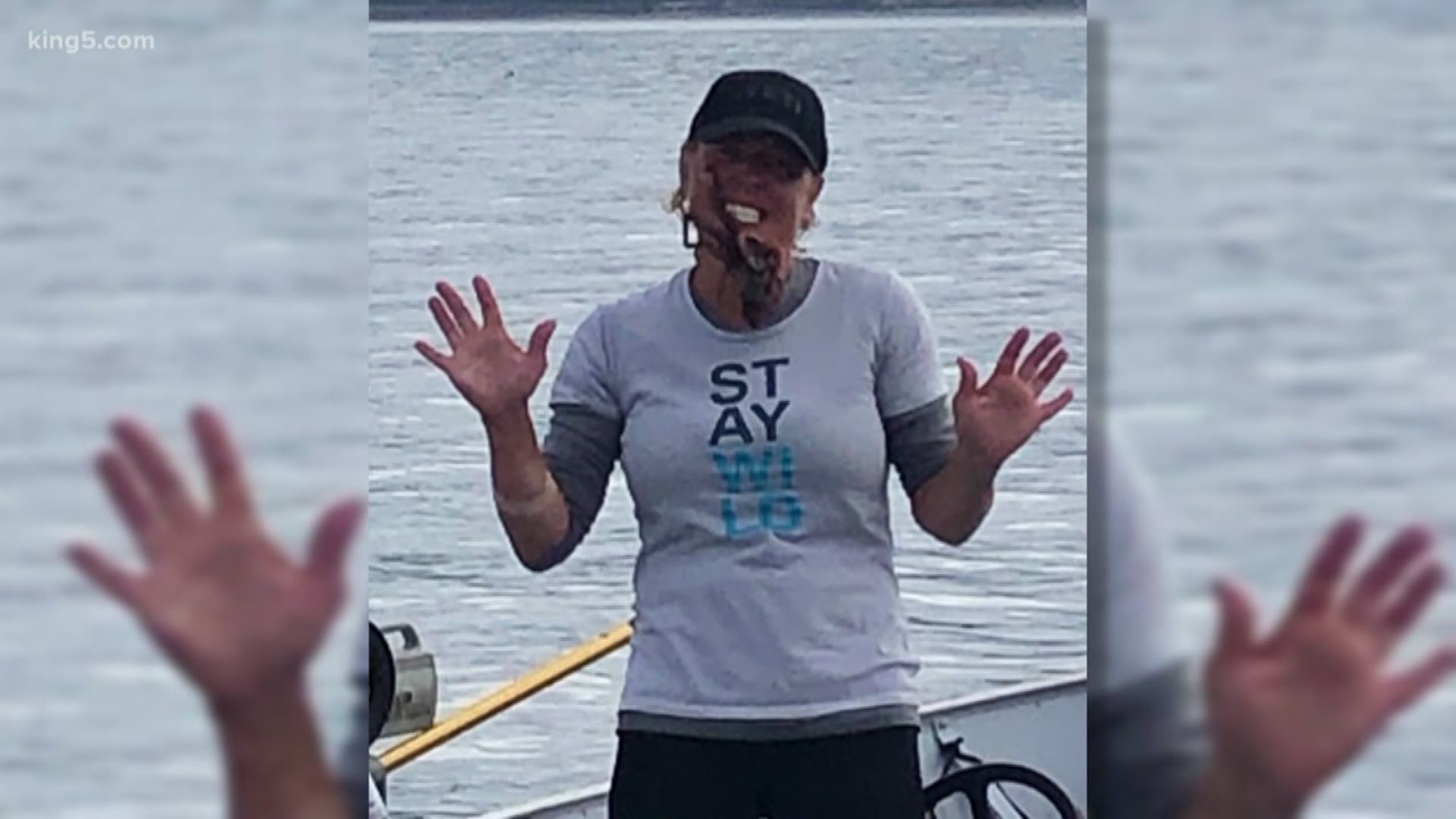 The Fox Island woman was bitten by the Giant Pacific Octopus after putting it near her face to pose for a photo.