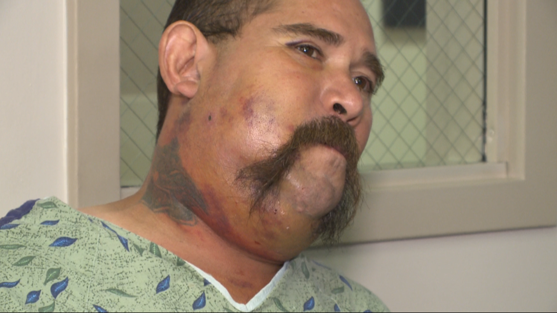 Arizona man played with a rattlesnake, got bit in the face