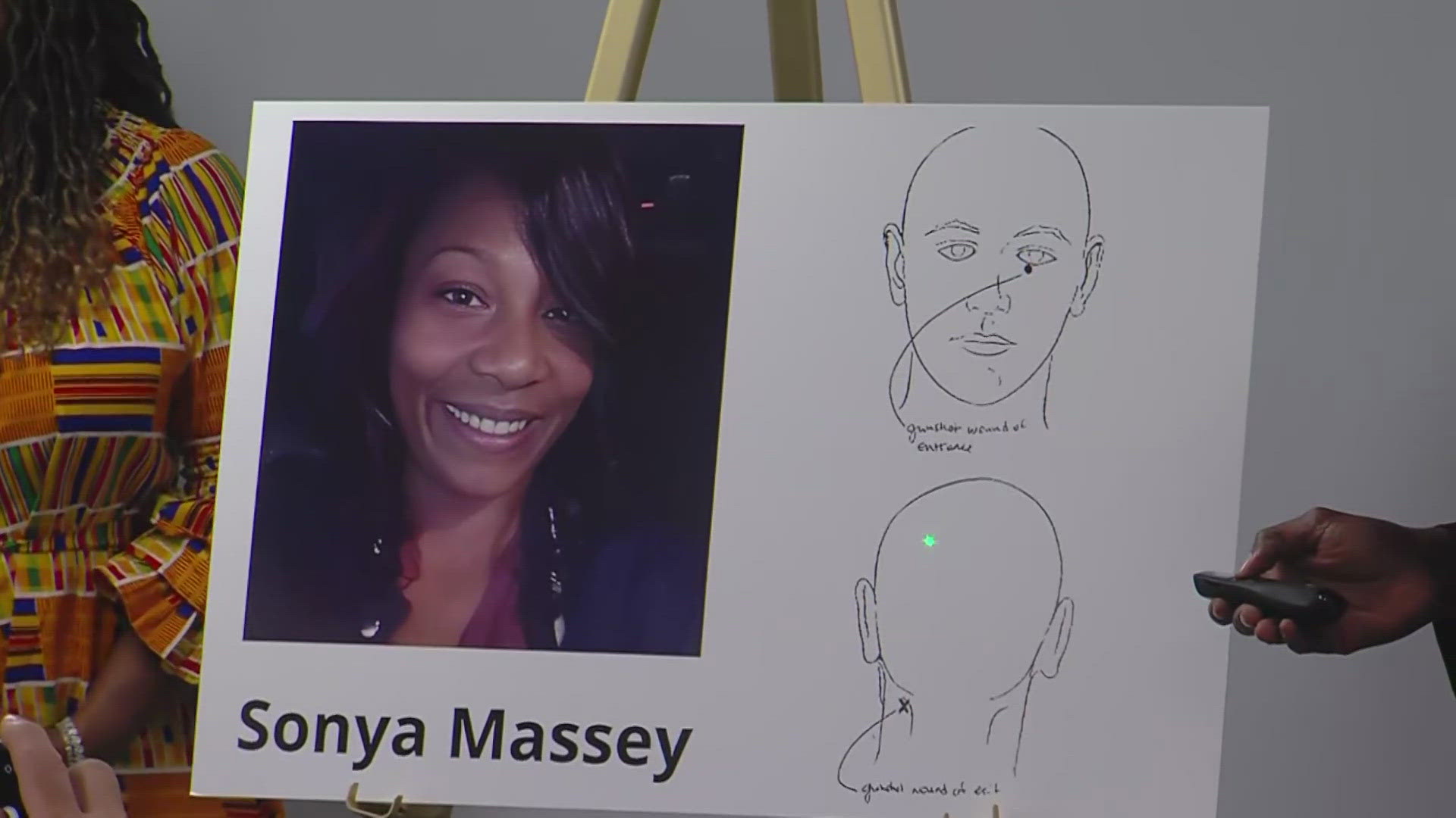 The autopsy shows a bullet fired by Deputy Sean Grayson went below Massey's left eye and exited through the back of her neck. Grayson was charged with murder.