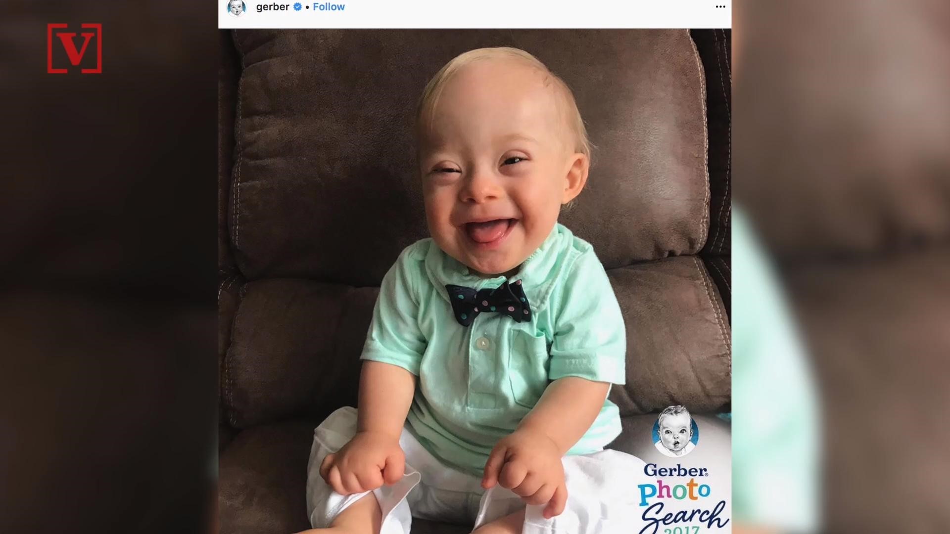 down syndrome gerber baby