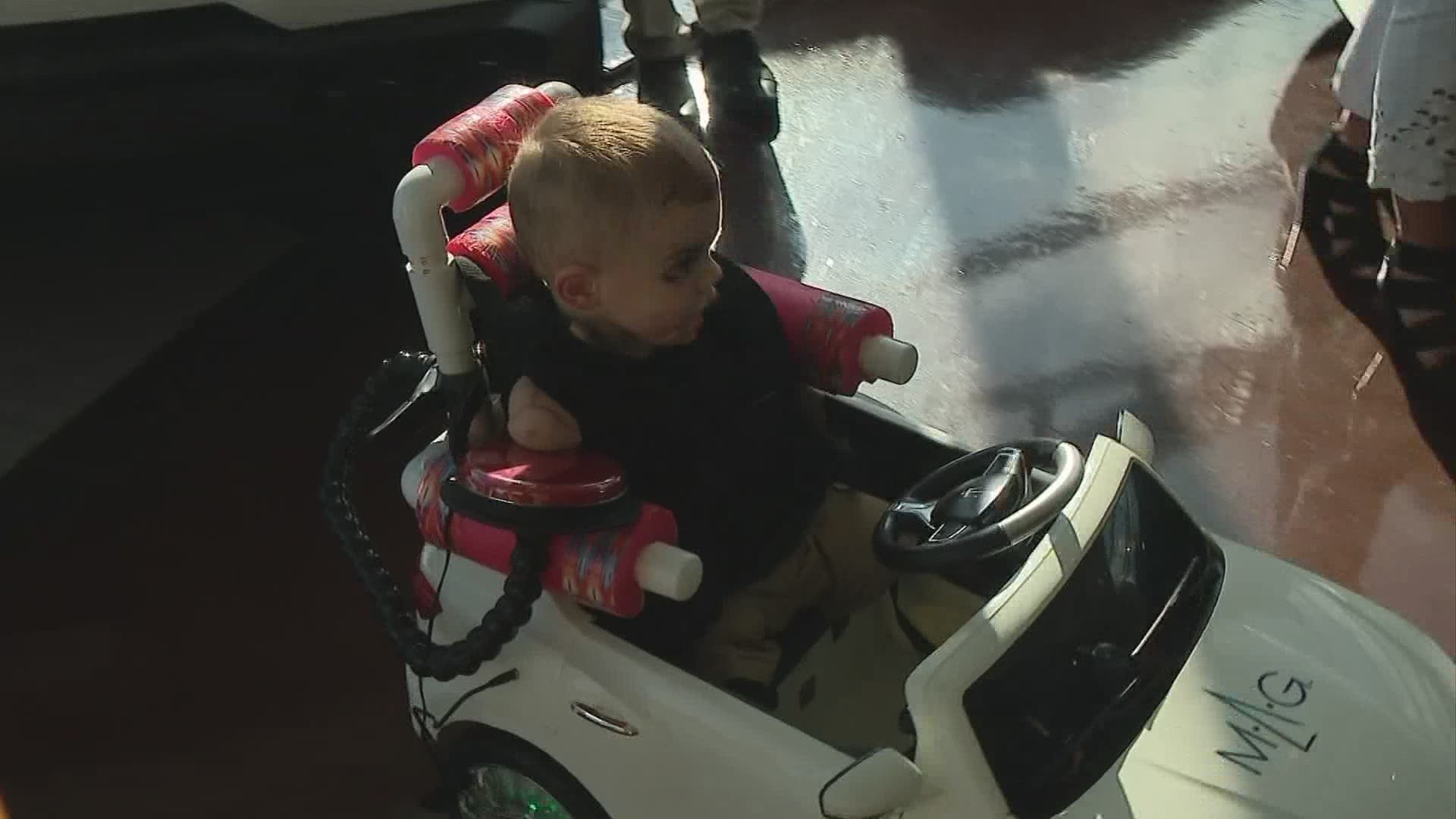 Strep caused Alexander to lose all his limbs but that isn't stopping him from moving.