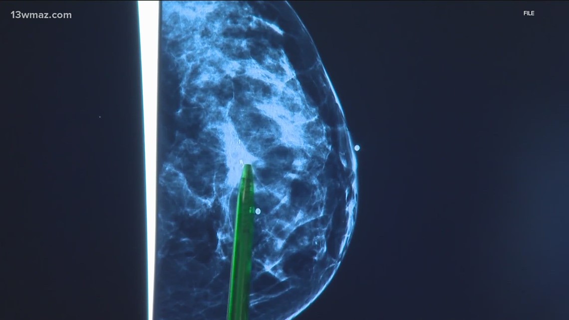 FDA Requires All Cancer Facilities To Give Breast Density Reports ...