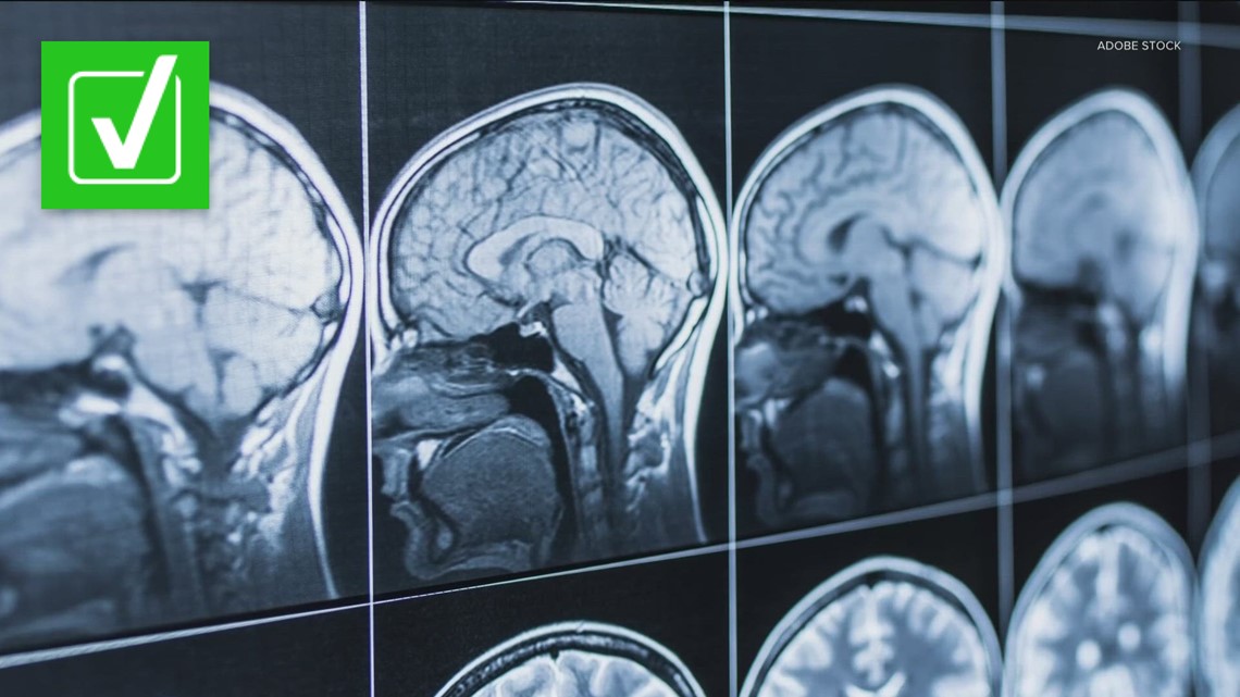 Verify | Yes, dementia is fatal, here's why - Vimarsana News