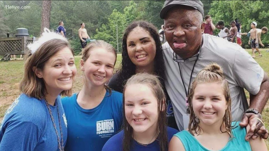 Firefighter Burn Foundation donations for camp