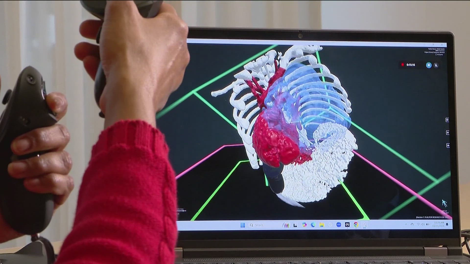 The technology was recently used to help doctors see and plan to removal of a baby's tumor.