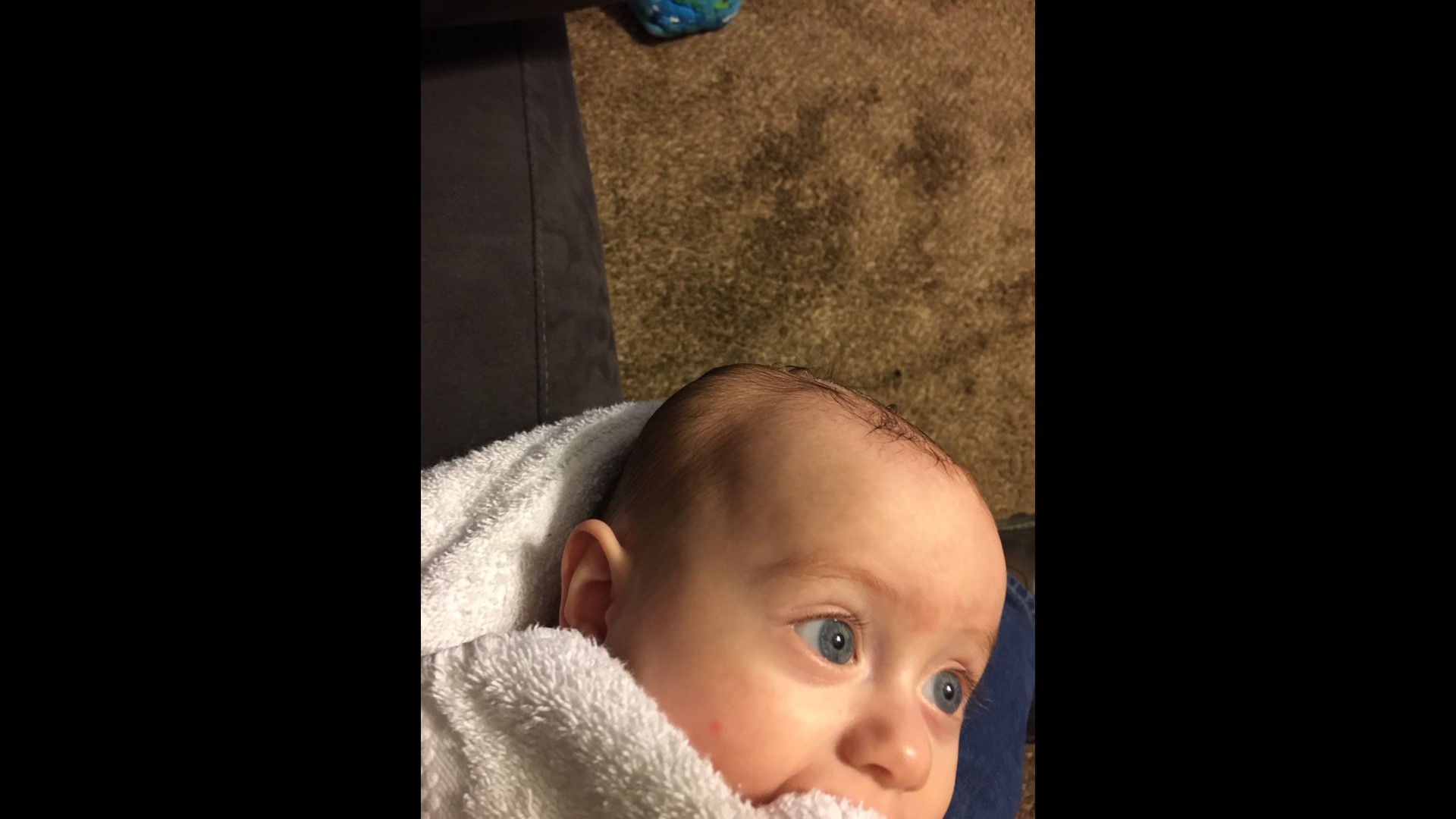 Baby Fell and Has Golf Ball Size Bump on Head Epps Andith