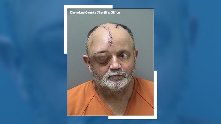 Suspect trades hospital for jail weeks after allegations of 