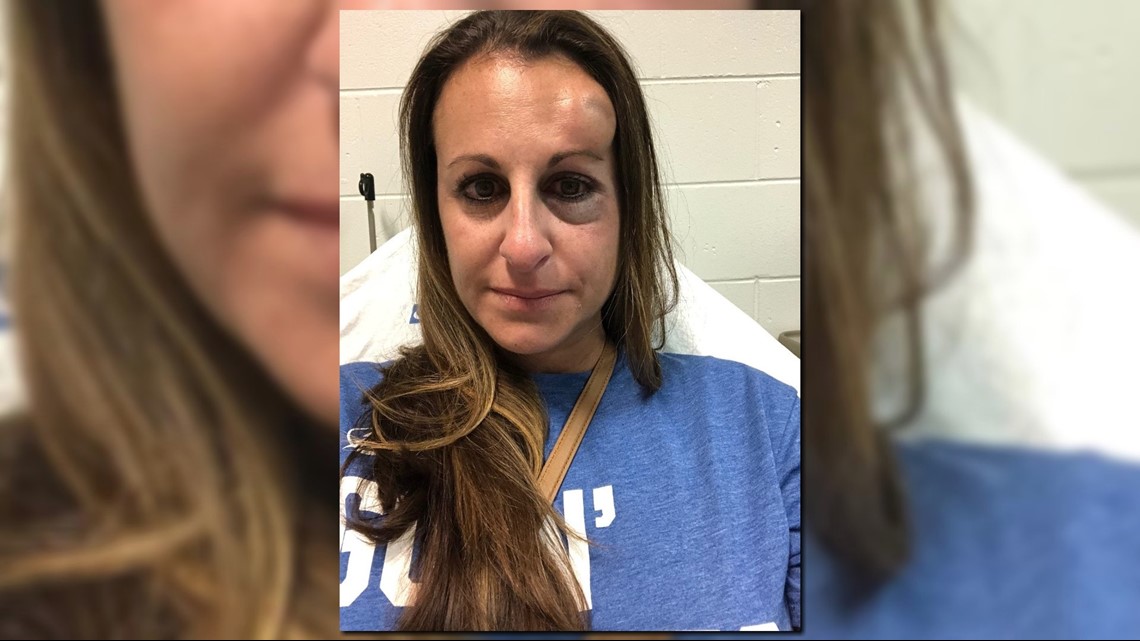 Fan struck by flying hockey puck during playoff game