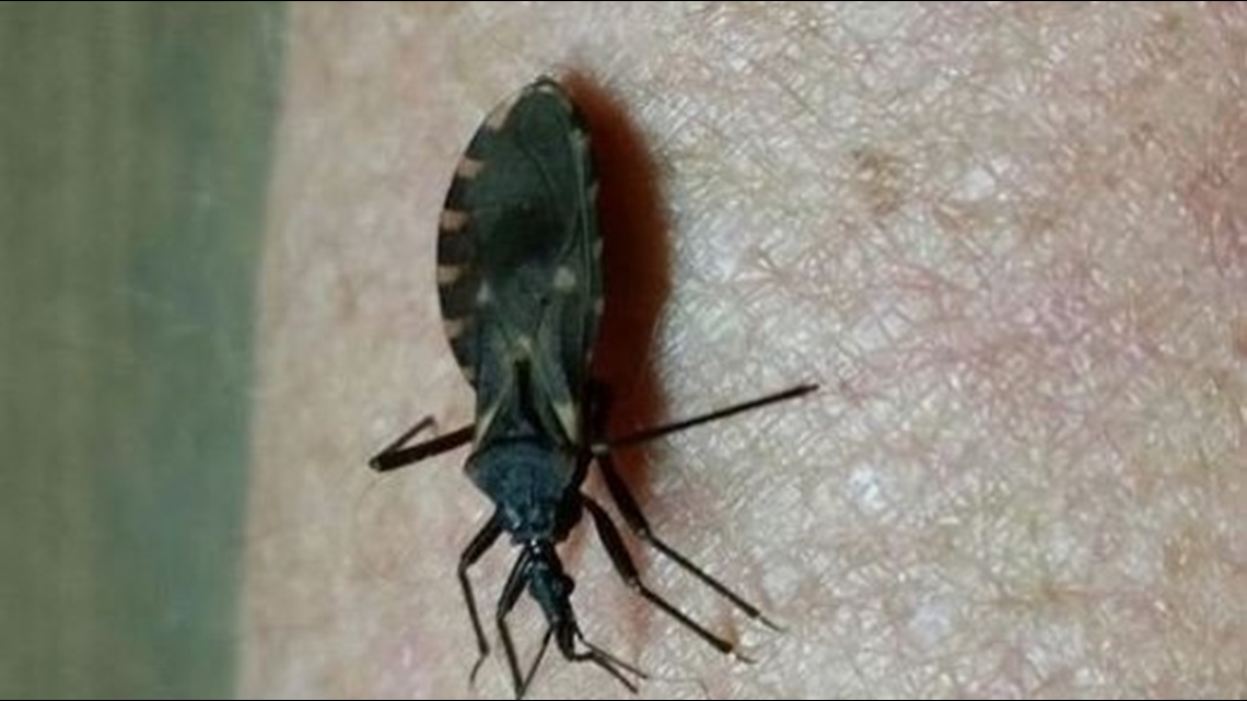 Kissing bug | What you should know about Chagas disease | 11alive.com