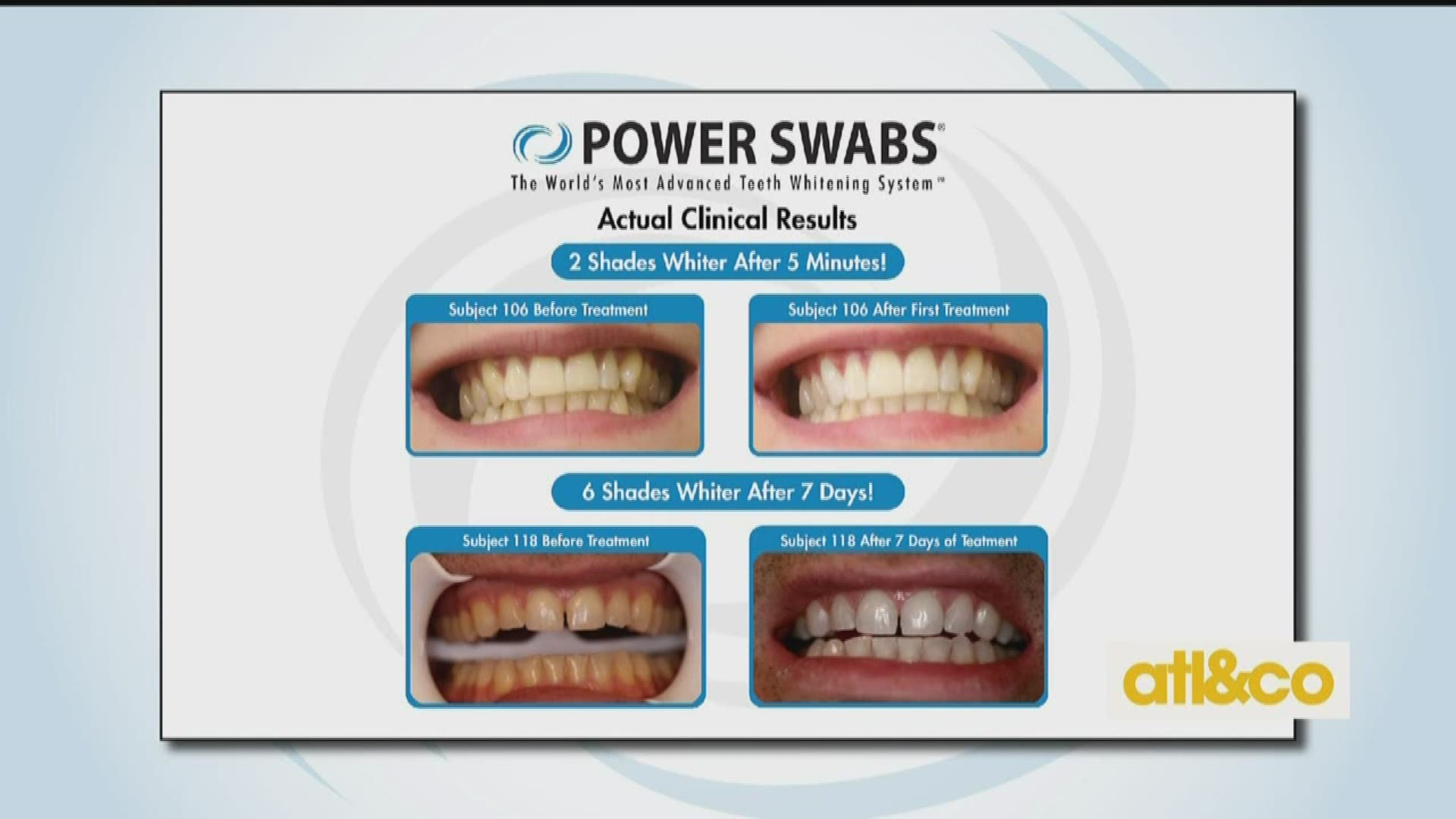 Get a special offer from Power Swabs and whiten your teeth today!
