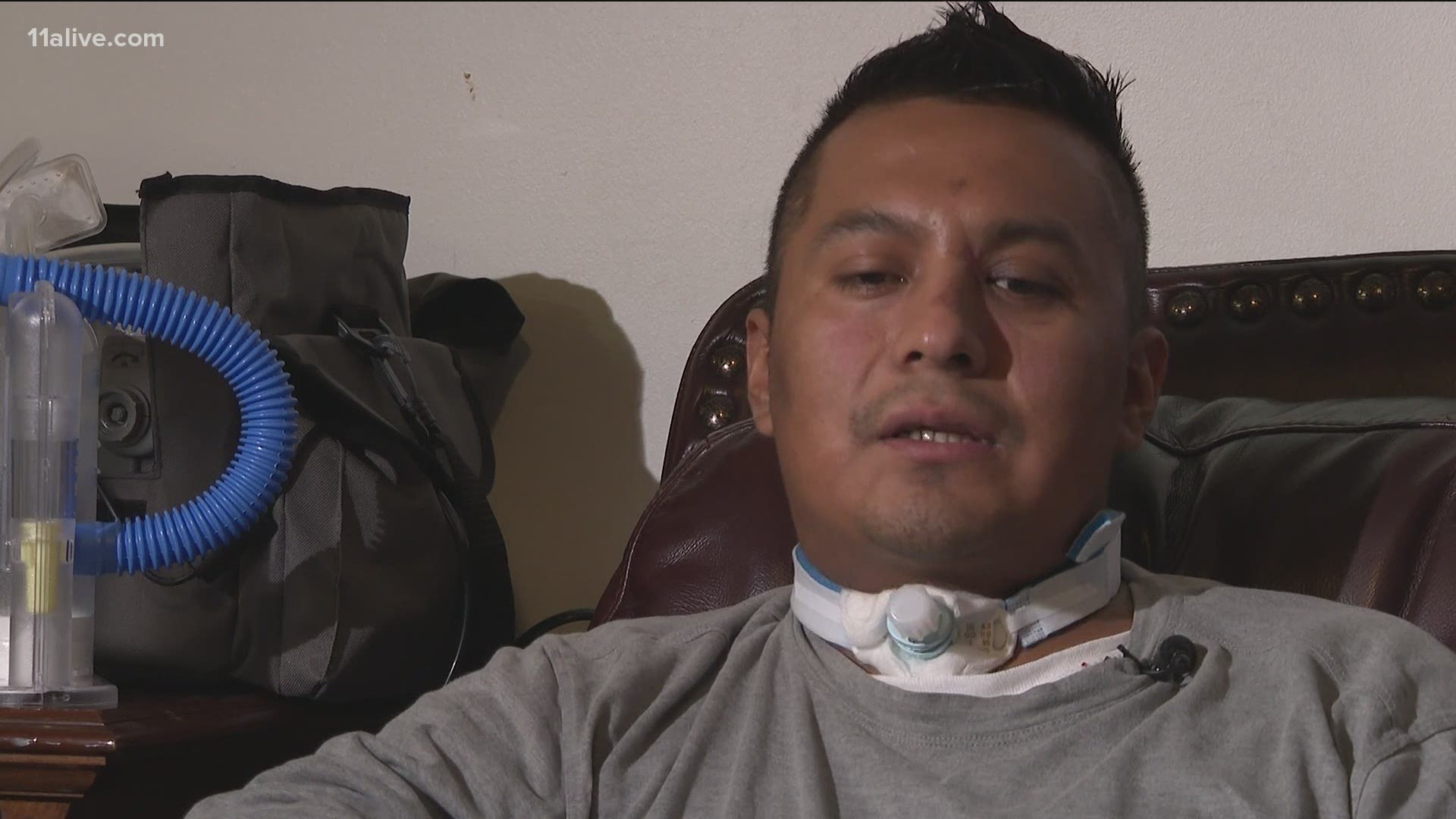 After nearly one month in the hospital, Elcias Hernandez-Ortiz is finally back home and sharing his story after he was shot on March 16.