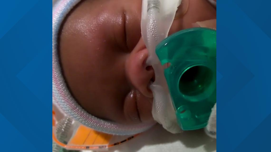 Infant of Georgia woman who carried baby while brain dead still fighting for his life