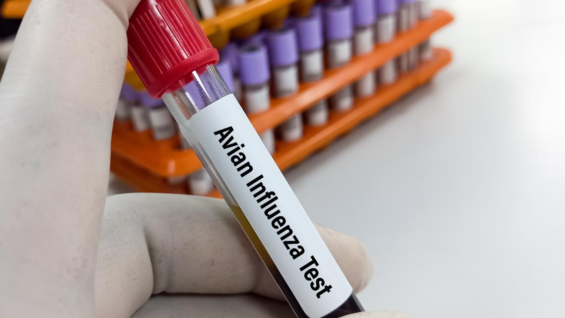 Bird flu detected in Henry County backyard flock