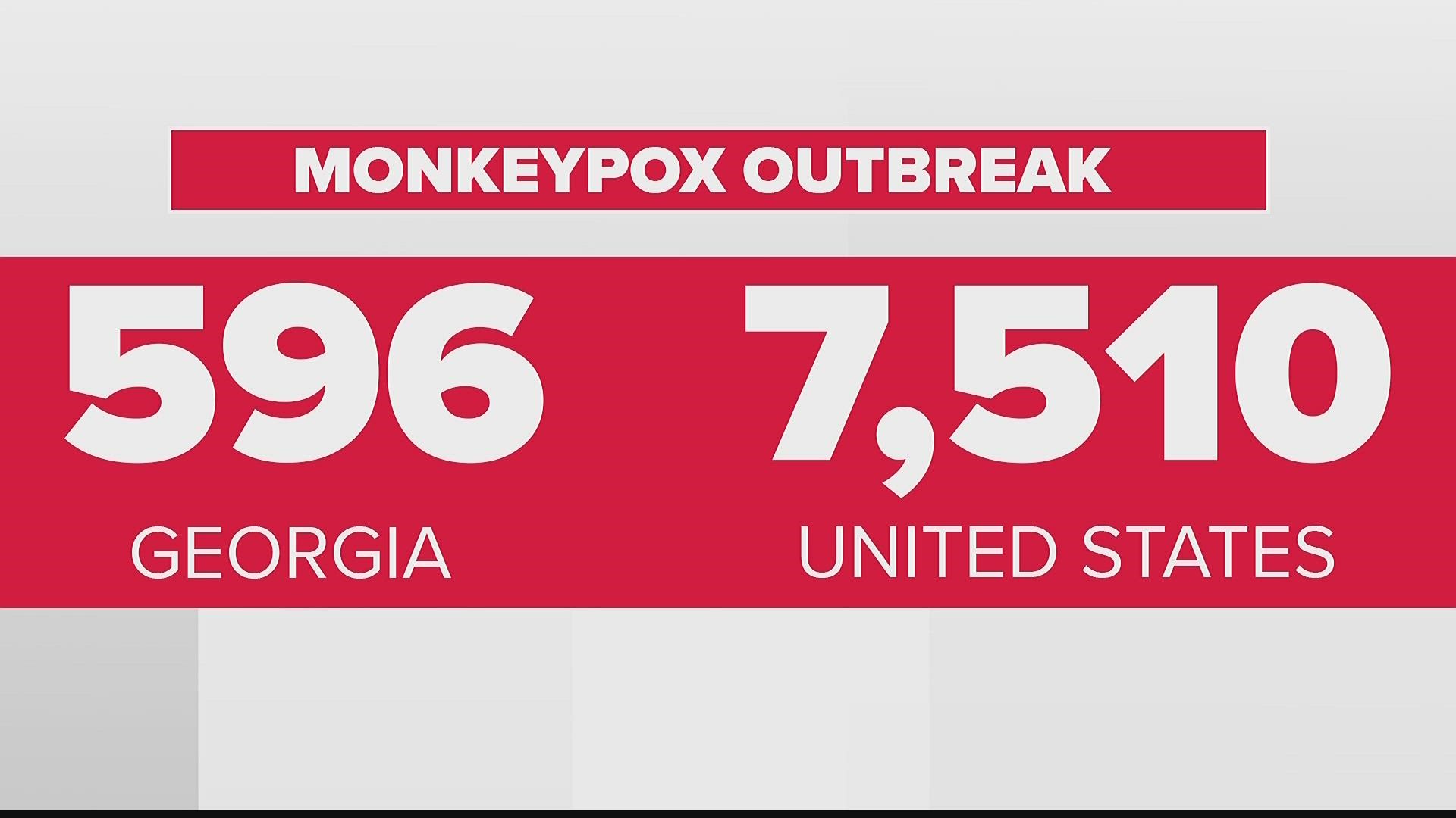 Dr. Sujatha Reddy answers several questions about monkeypox for 11Alive as monkeypox cases continue to increase in Georgia.