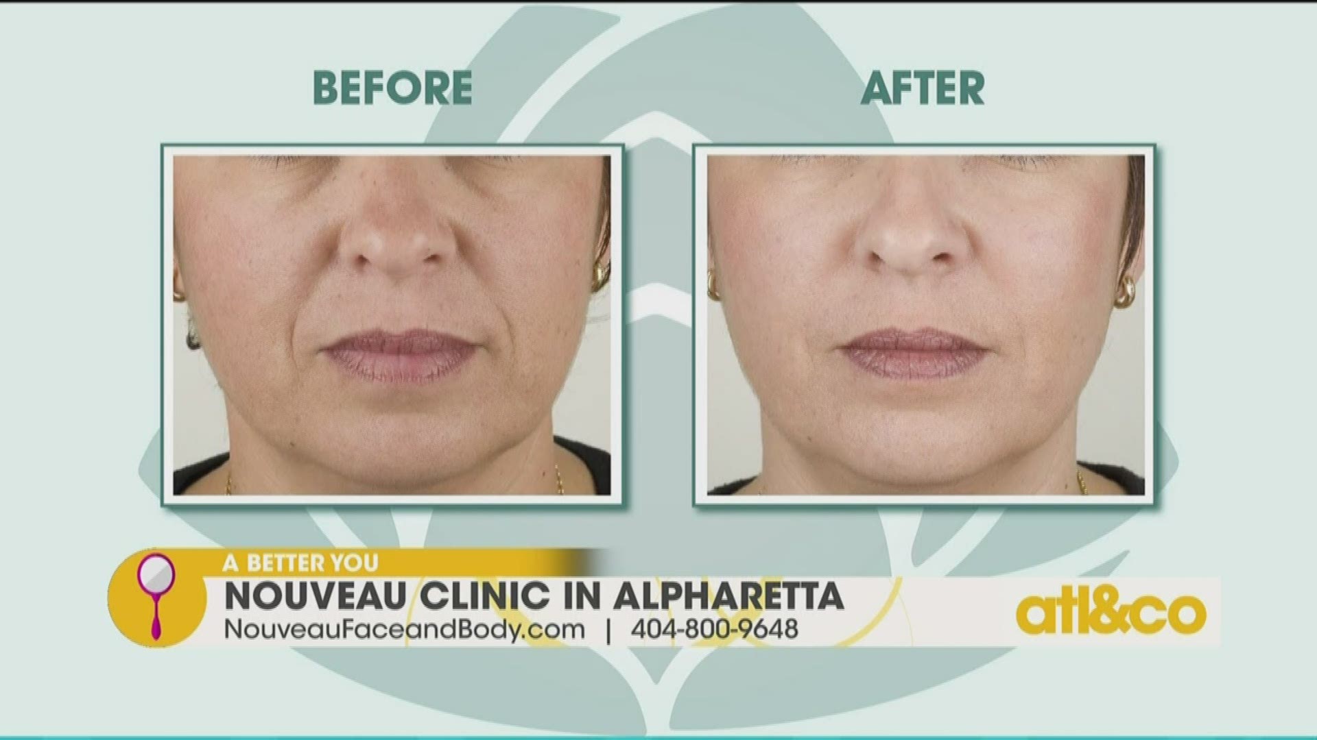 Learn about anti-aging skin treatment The Gentle Lift from Nouveau Clinic on 'Atlanta & Company'