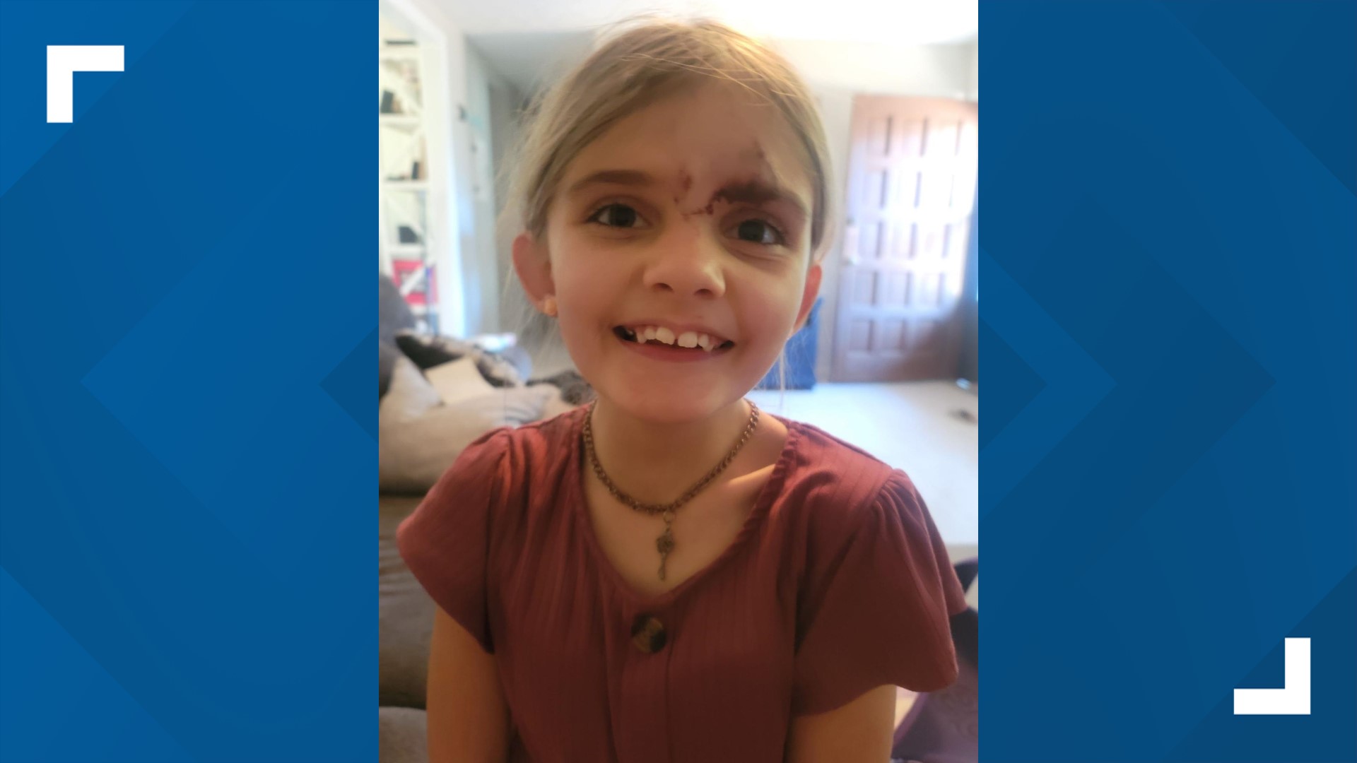 An 8-year-old girl was seriously injured in Athens when she was attacked by a dog right outside her own home. WARNING: Some of the pictures of the bite are graphic.