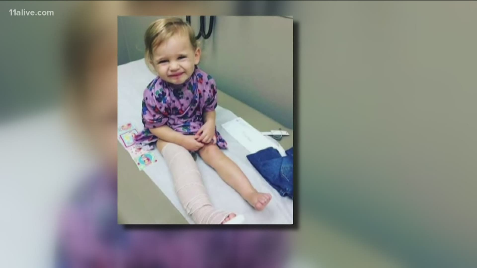 Doctors said the toddler's injuries were very painful and required a lot of force to create.