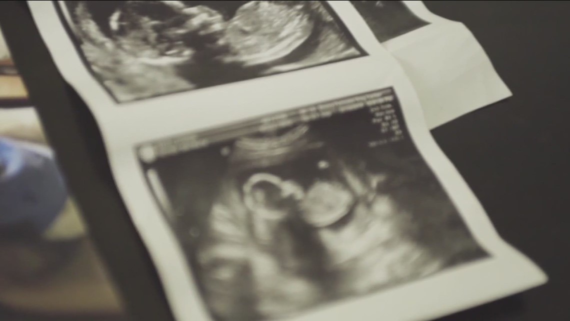 Georgia lawmakers talk solutions for high maternal mortality rate - Vimarsana News