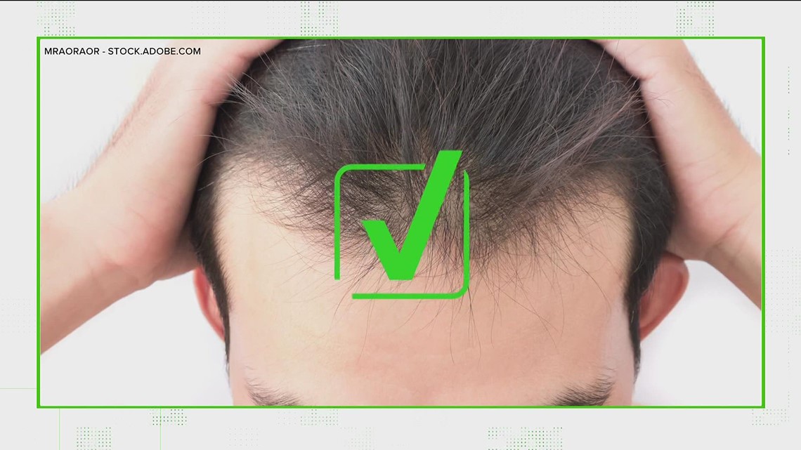 This is how to spot hair loss  9 Vitamins that Stop Hair Thinning bald  patches balding and more  It Really Works Vitamins Naturally Prevent Hair  Loss blog