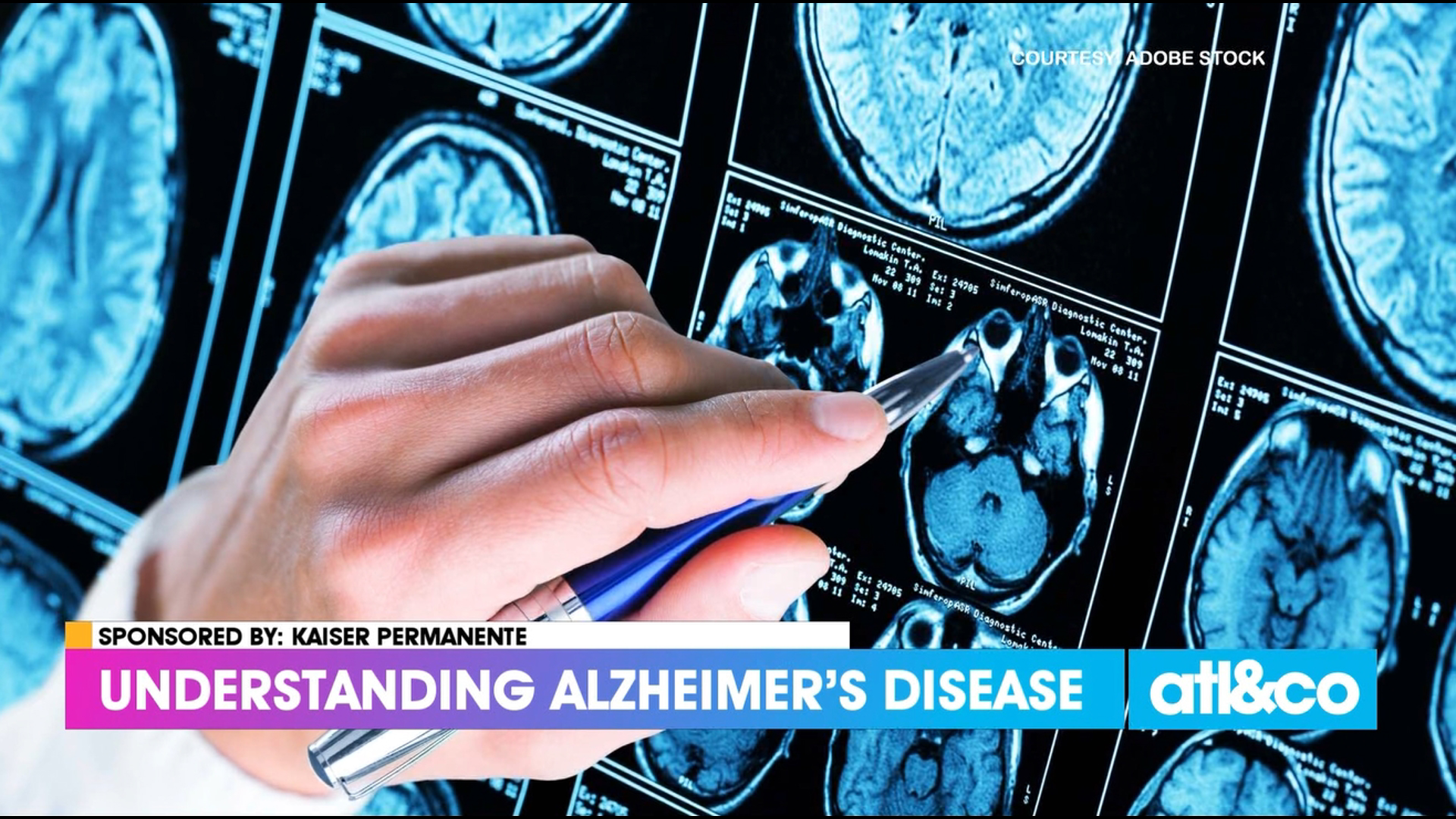 Dr. Jaza Marina from Kaiser Permanente talks about the signs and symptoms of Alzheimer's disease.