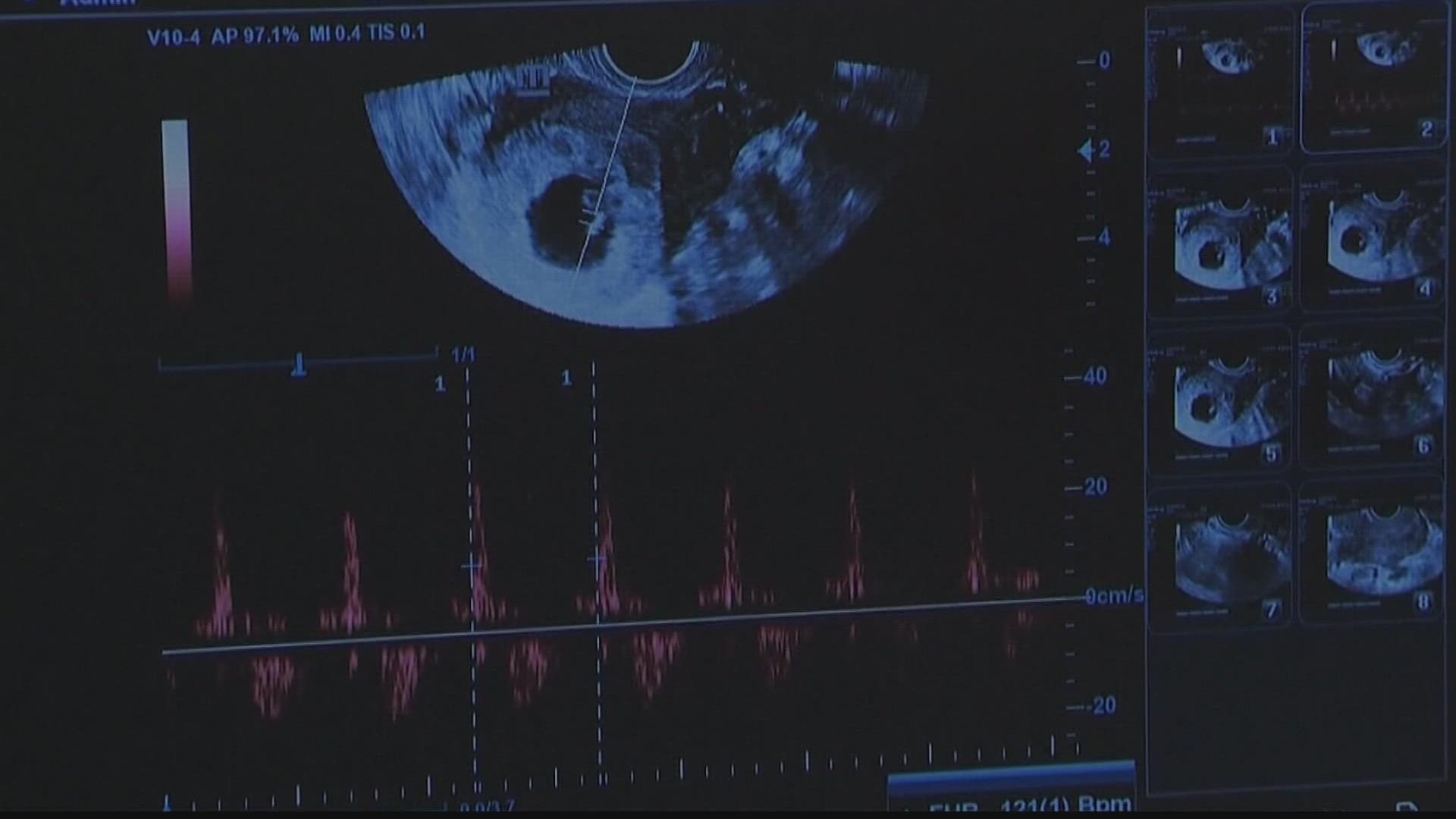 The 11th Circuit in Atlanta will make the decision on what happens next with the law, which bans abortions at about six weeks.