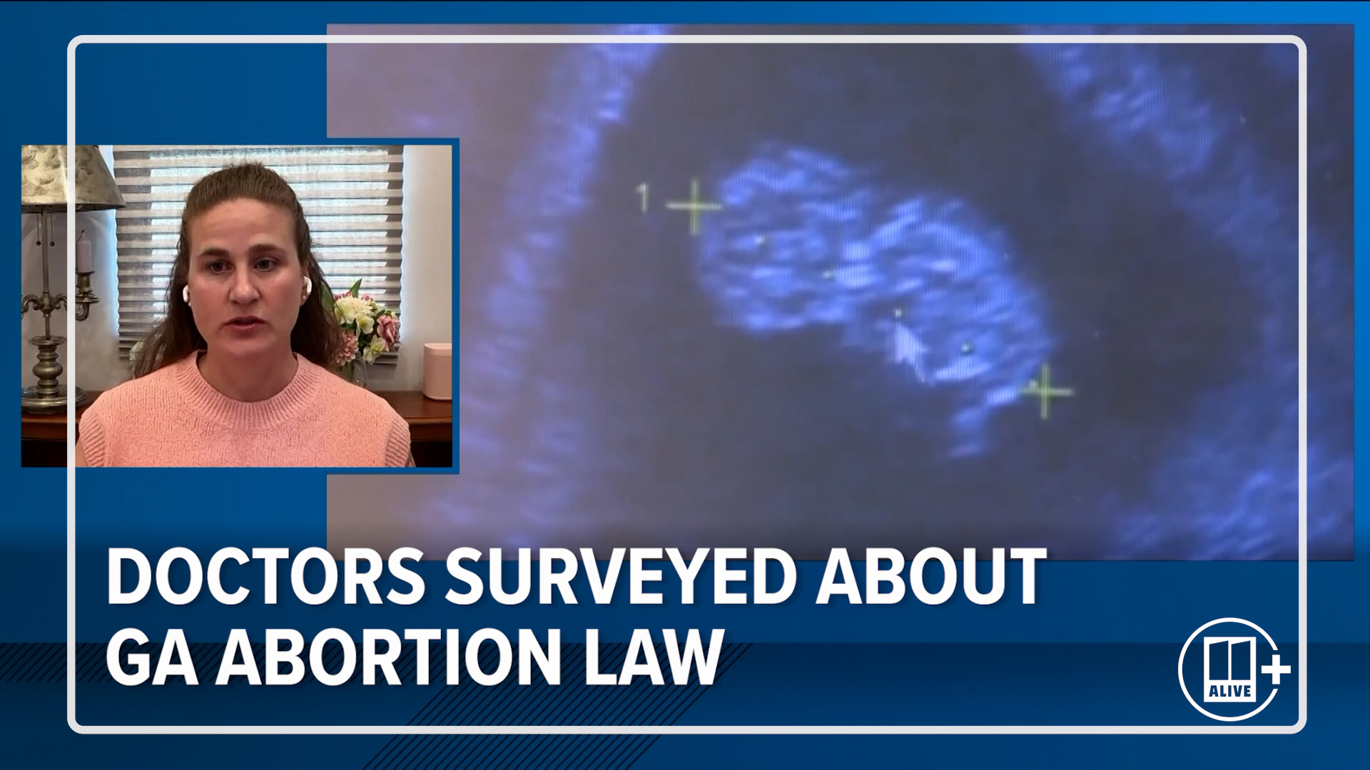 11Alive News anchor Faith Jessie speaks with Athens OB/GYN Lara Hart, MD about the impact of Georgia's abortion law on women's health.