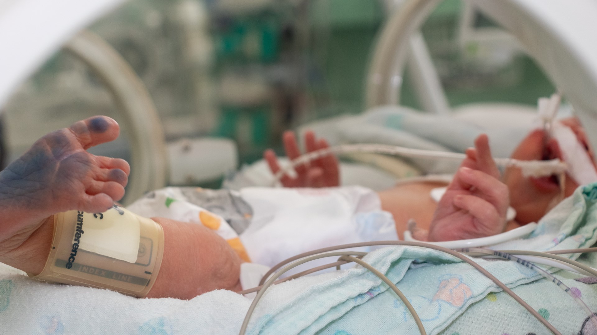 Nearly 380,000 babies are born prematurely in the U.S. each year.