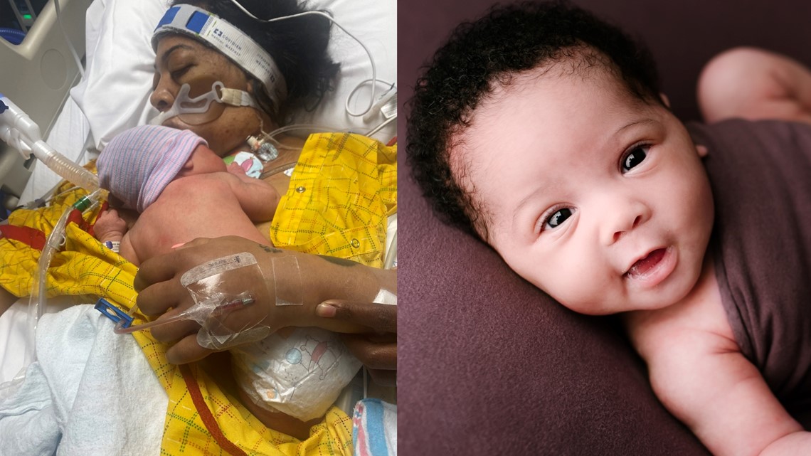 Mom, baby survive catastrophic and rare amniotic fluid embolism