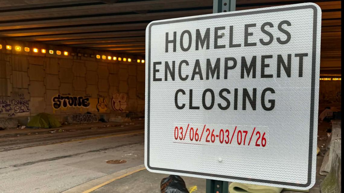 Homeless encampment close to Grady Hospital inflicting concern as metropolis will get set to shut it Homeless encampment close to Grady Hospital inflicting concern as metropolis will get set to shut it