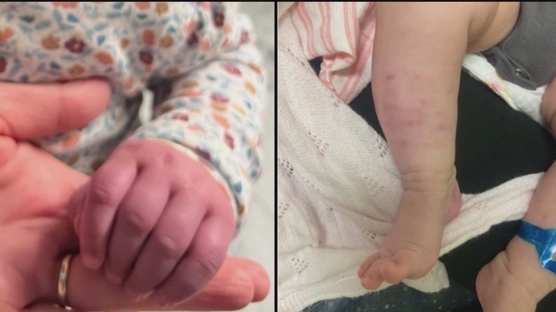 Lawmaker pushes to ease access to medical records for parents accused of abuse