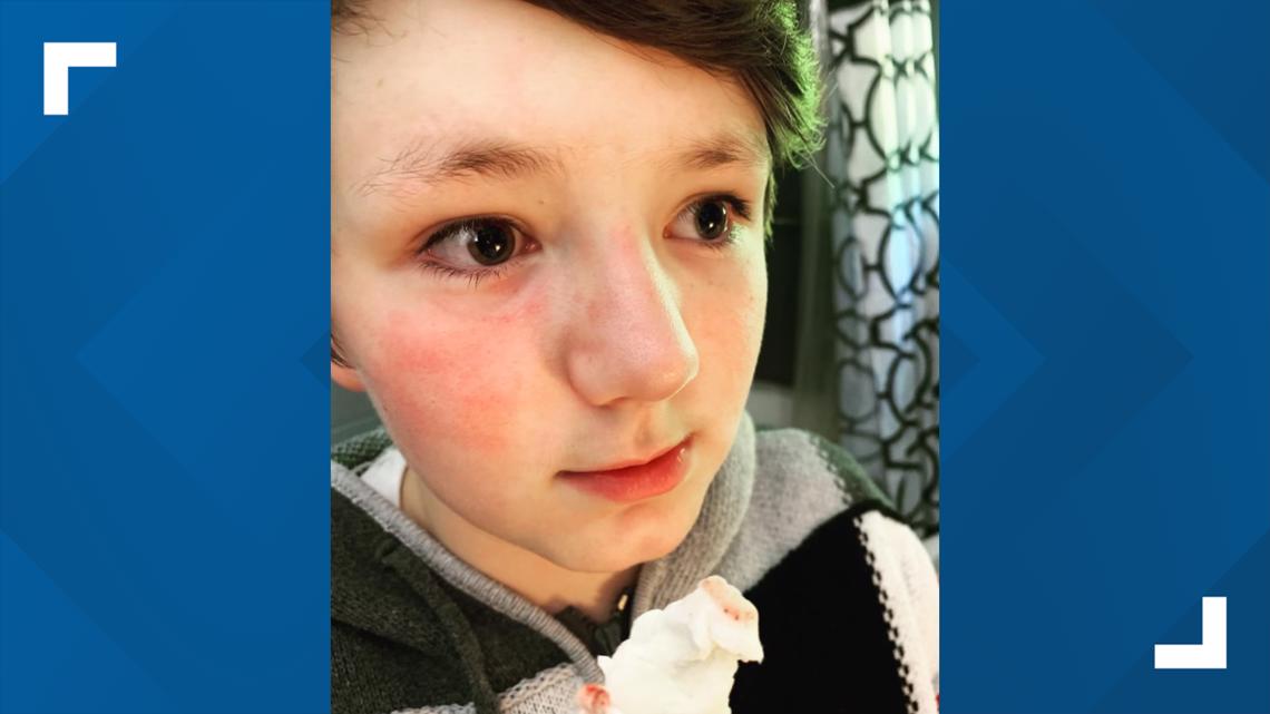 Douglas County 7th grader bullied - Vimarsana News