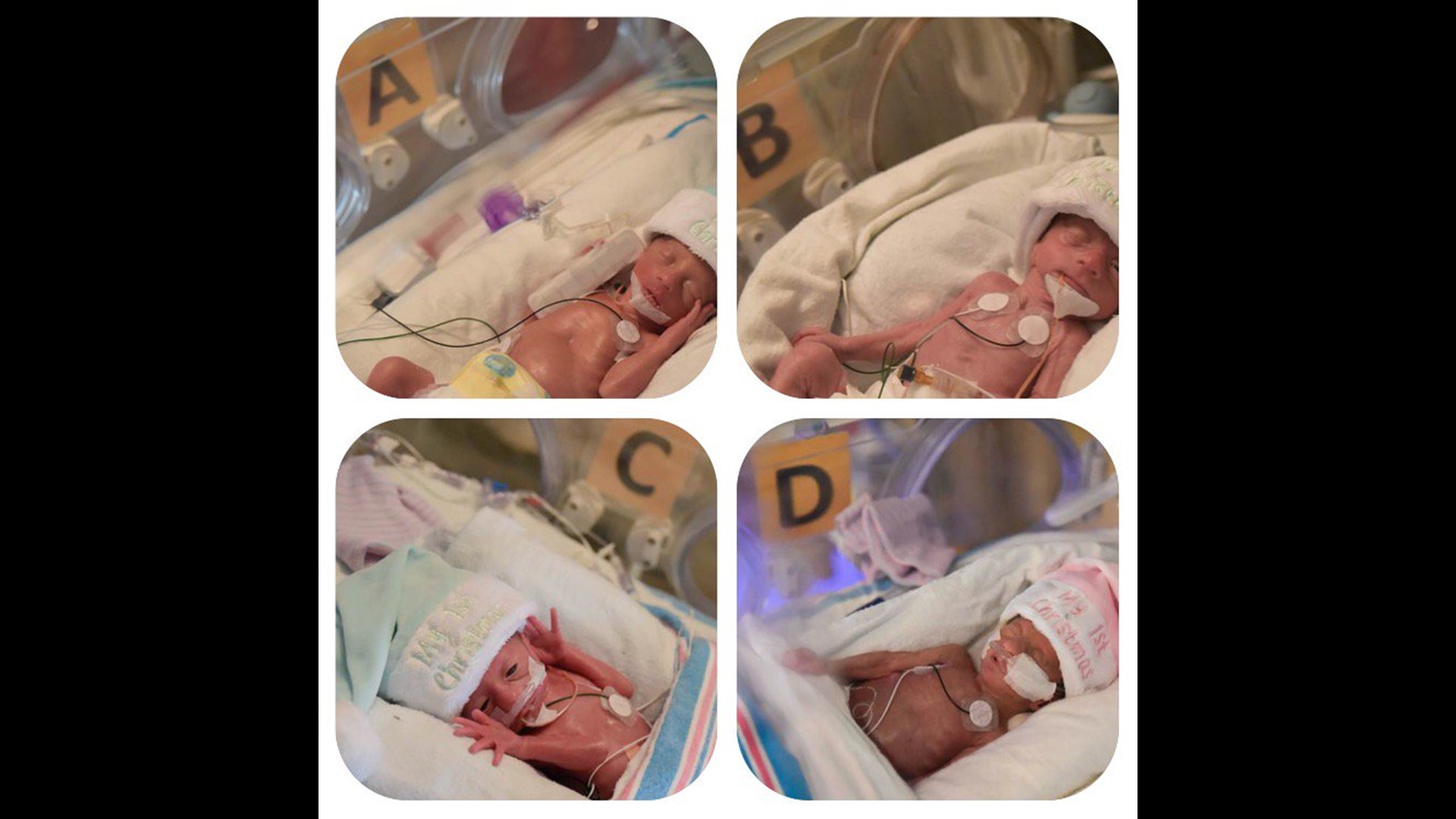 Naturally conceived quadruplets born at Piedmont